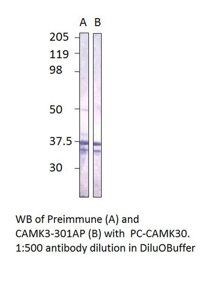 CaMKII gamma Antibody in Western Blot (WB)