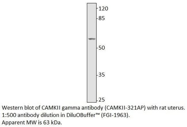 CaMKII gamma Antibody in Western Blot (WB)