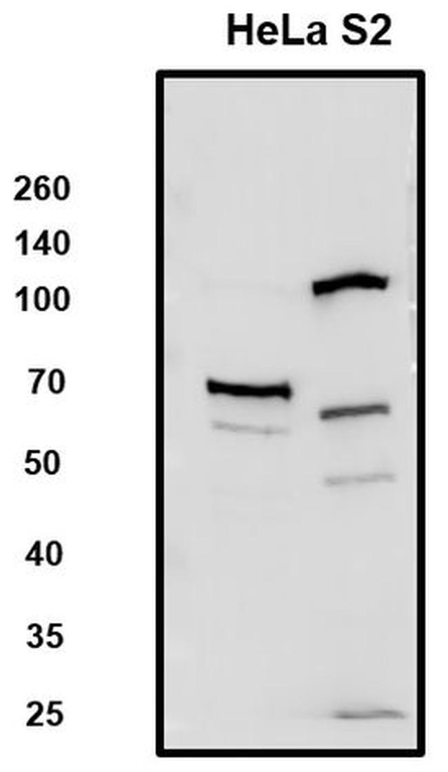 SLC7A1 Antibody in Western Blot (WB)