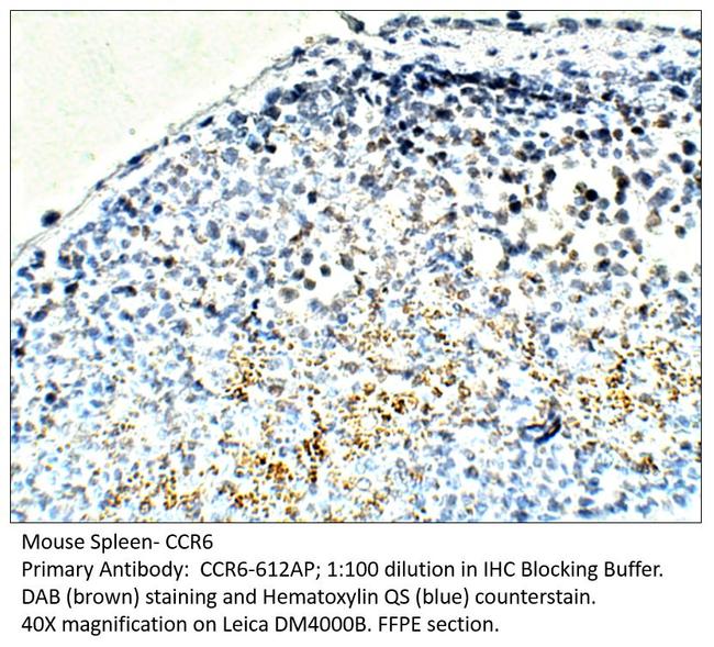 CCR6 Antibody in Immunohistochemistry (IHC)