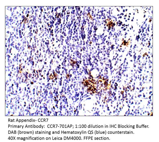 CCR7 Antibody in Immunohistochemistry (IHC)