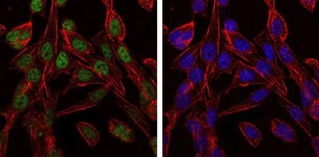 TCP-1 beta Antibody in Immunocytochemistry (ICC/IF)