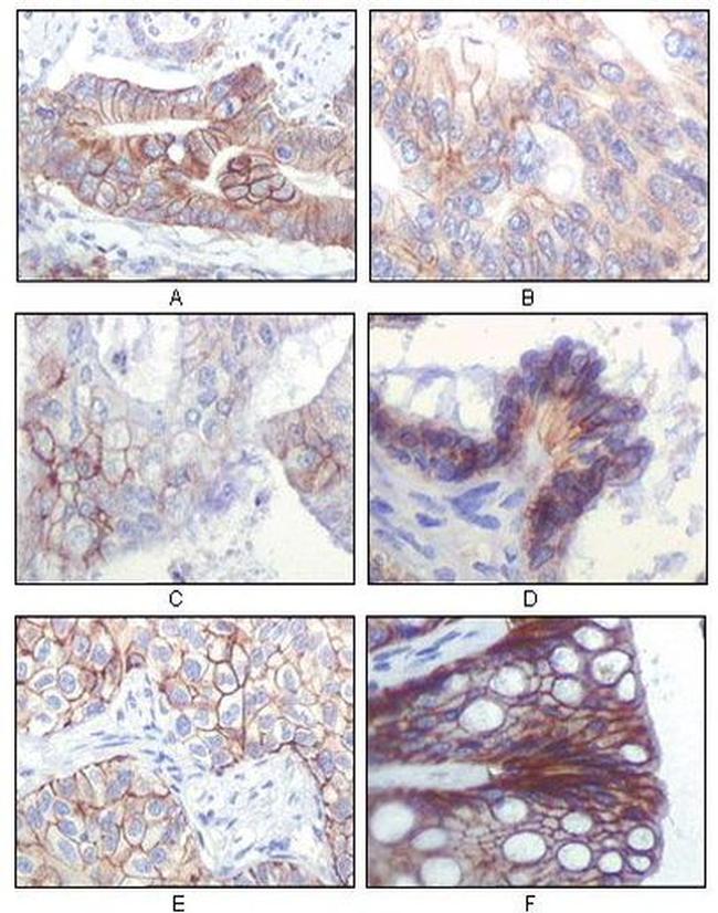 IGF1R beta Antibody in Immunohistochemistry (Paraffin) (IHC (P))