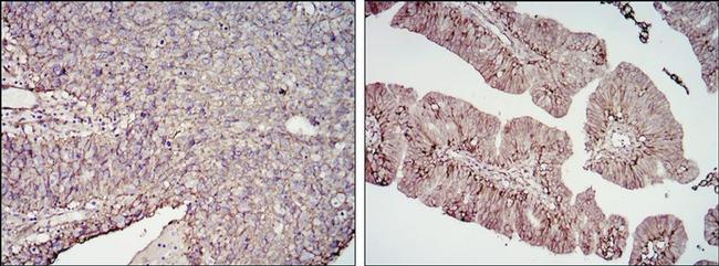 B7-H3 Antibody in Immunohistochemistry (Paraffin) (IHC (P))