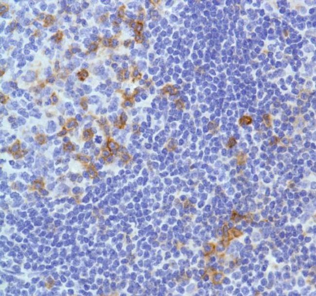 ICOS (CD278) Antibody in Immunohistochemistry (Paraffin) (IHC (P))