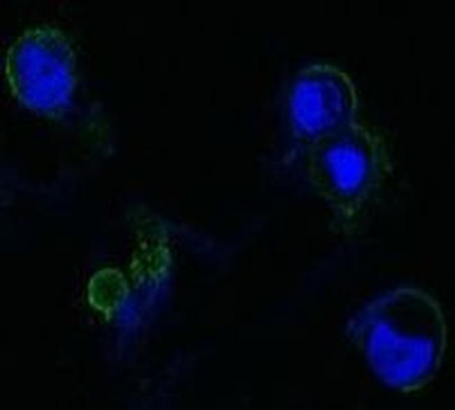 FGFR4 Antibody in Immunocytochemistry (ICC/IF)