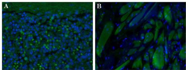 CD35 Antibody in Immunohistochemistry (Paraffin) (IHC (P))