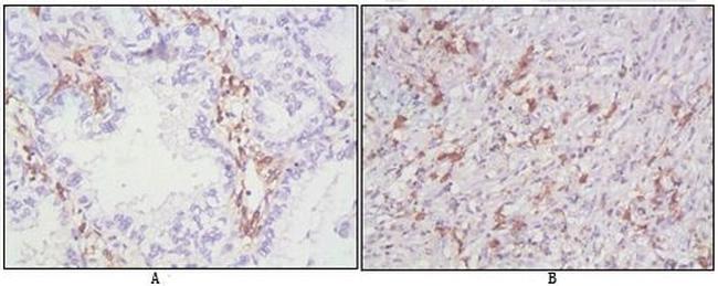 CD38 Antibody in Immunohistochemistry (Paraffin) (IHC (P))