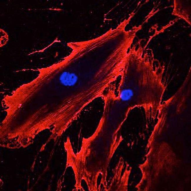 CD44 Antibody in Immunocytochemistry (ICC/IF)