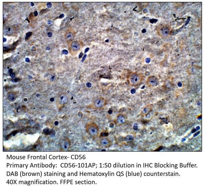 CD56/NCAM Antibody in Immunohistochemistry (IHC)