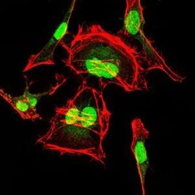 CDK2 Antibody in Immunocytochemistry (ICC/IF)