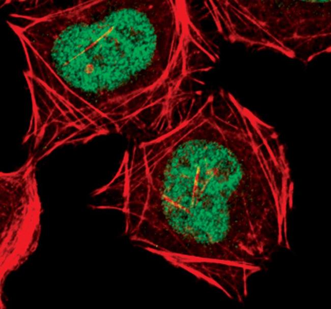 CDK9 Antibody in Immunocytochemistry (ICC/IF)