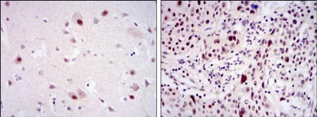 CDK9 Antibody in Immunohistochemistry (Paraffin) (IHC (P))