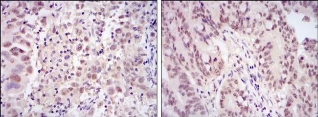 CDK9 Antibody in Immunohistochemistry (Paraffin) (IHC (P))