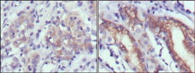 CER1 Antibody in Immunohistochemistry (Paraffin) (IHC (P))