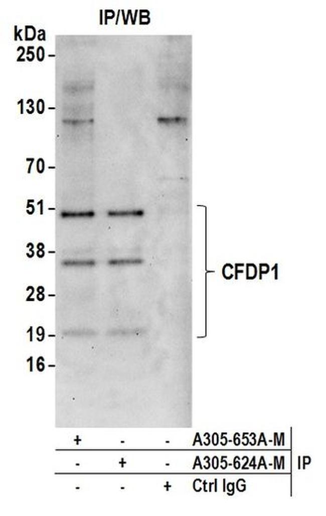 CFDP1 Antibody in Immunoprecipitation (IP)