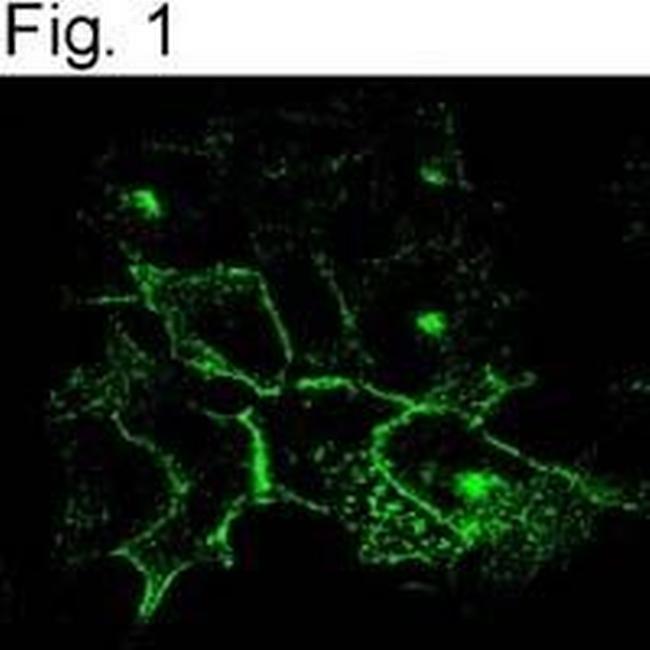 CFTR Antibody in Immunocytochemistry (ICC/IF)