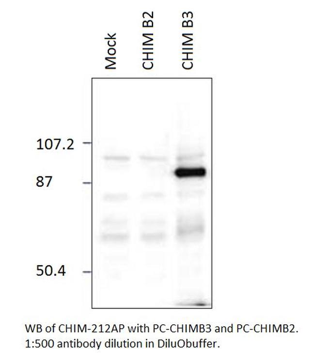 Chimaerin beta 3 Antibody in Western Blot (WB)