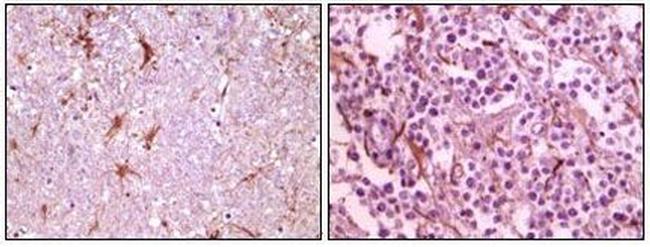 Calmyrin Antibody in Immunohistochemistry (Paraffin) (IHC (P))