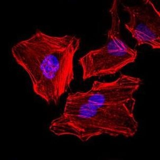 Cytokeratin 5 Antibody in Immunocytochemistry (ICC/IF)