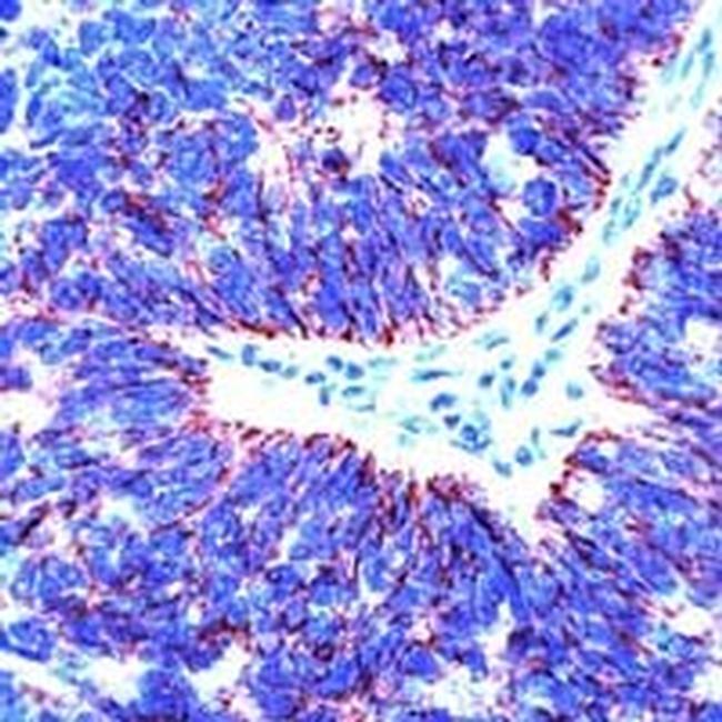 Claudin 7 Antibody in Immunohistochemistry (Paraffin) (IHC (P))