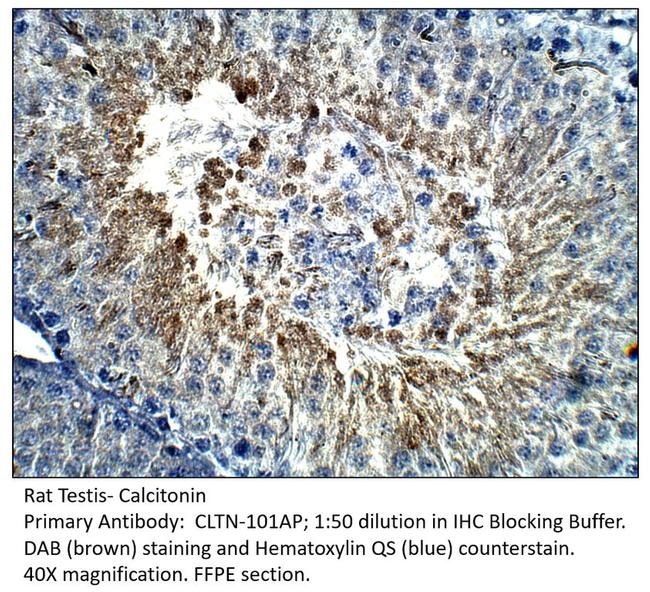 Calcitonin Antibody in Immunohistochemistry (IHC)