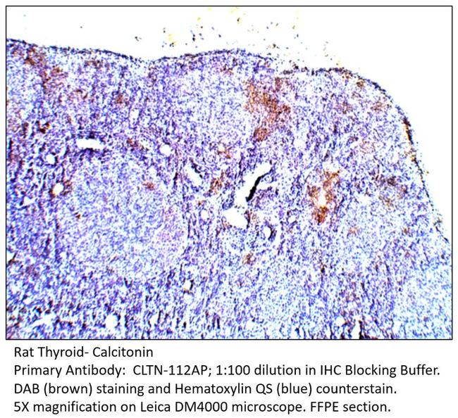 Calcitonin Antibody in Immunohistochemistry (IHC)