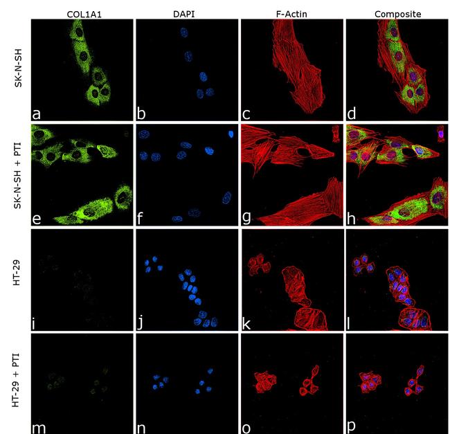 COL1A1 Antibody in Immunocytochemistry (ICC/IF)