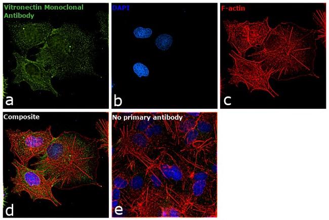 Vitronectin Antibody in Immunocytochemistry (ICC/IF)