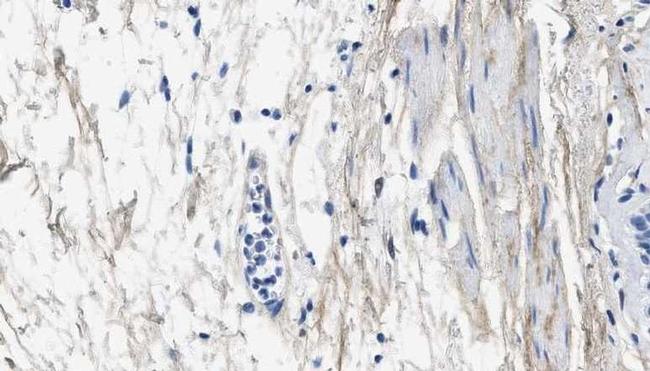 Collagen III (soluble) Antibody in Immunohistochemistry (Paraffin) (IHC (P))