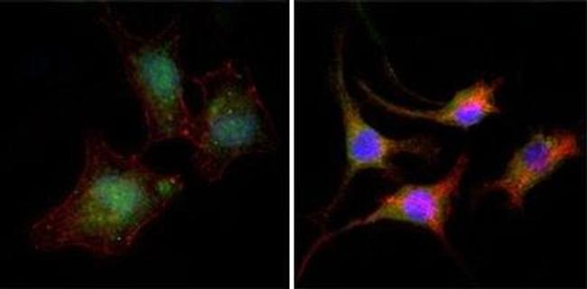 beta Catenin Antibody in Immunocytochemistry (ICC/IF)