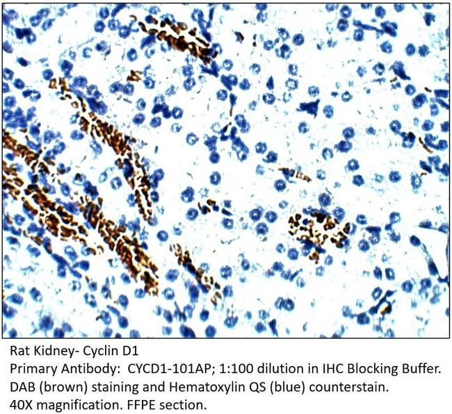 Cyclin D1 Antibody in Immunohistochemistry (IHC)