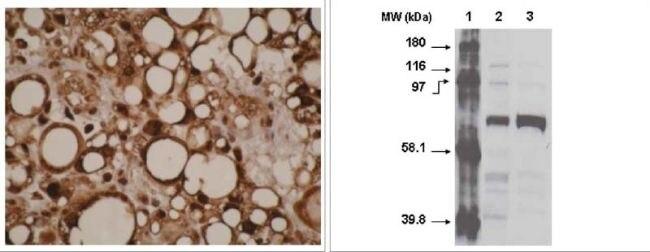 CYP4F11 Antibody in Immunohistochemistry (Paraffin) (IHC (P))