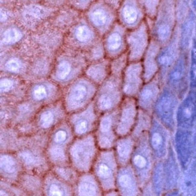 E-cadherin Antibody in Immunohistochemistry (Paraffin) (IHC (P))