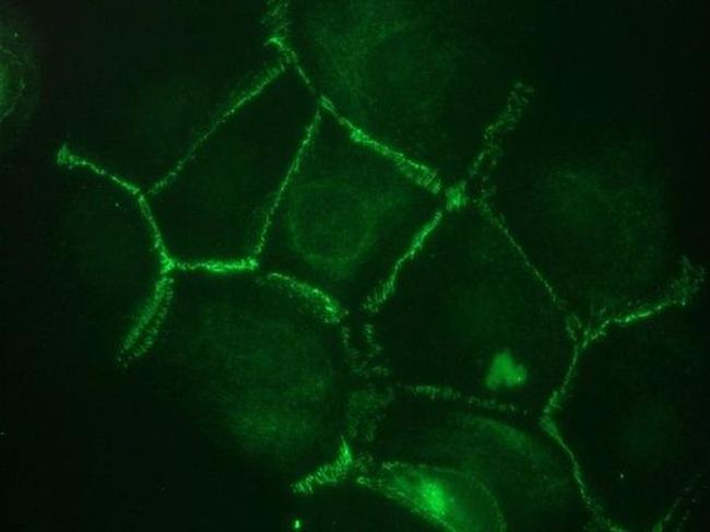 CDH11 Antibody in Immunocytochemistry (ICC/IF)