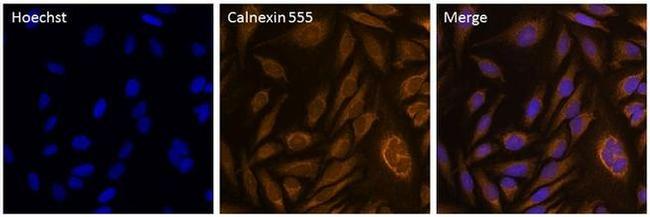 Calnexin Antibody in Immunocytochemistry (ICC/IF)