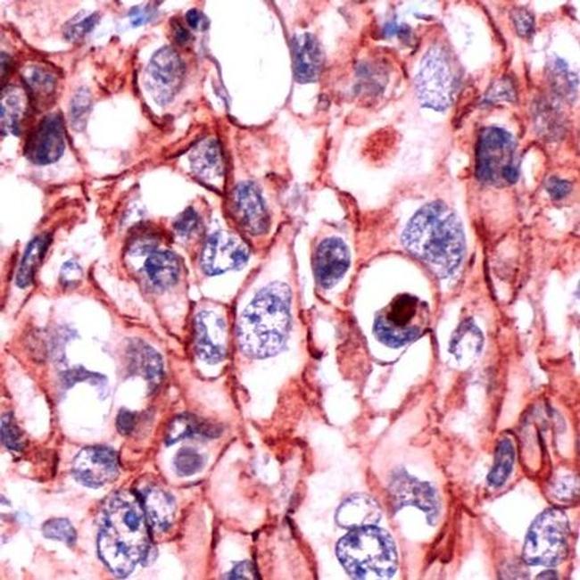 delta Catenin Antibody in Immunohistochemistry (Paraffin) (IHC (P))