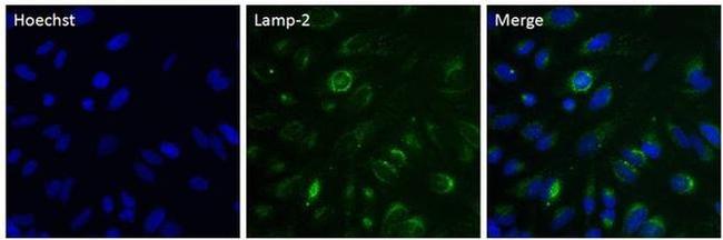 LAMP2 Antibody in Immunocytochemistry (ICC/IF)