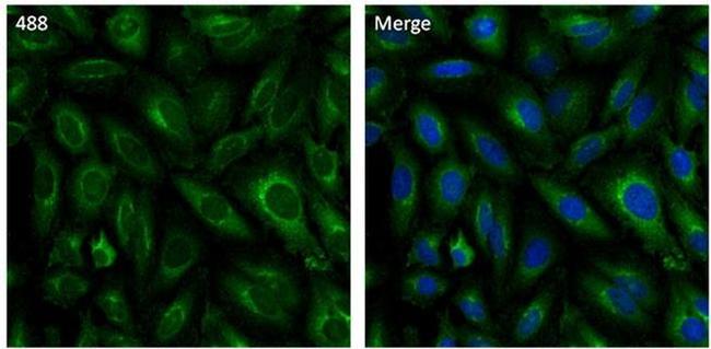 Clathrin Heavy Chain Antibody in Immunocytochemistry (ICC/IF)