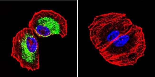 Clathrin Heavy Chain Antibody in Immunocytochemistry (ICC/IF)