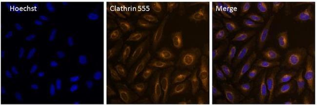 Clathrin Heavy Chain Antibody in Immunocytochemistry (ICC/IF)