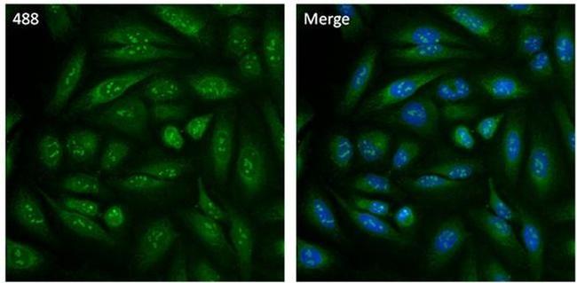 Cyclophilin B Antibody in Immunocytochemistry (ICC/IF)