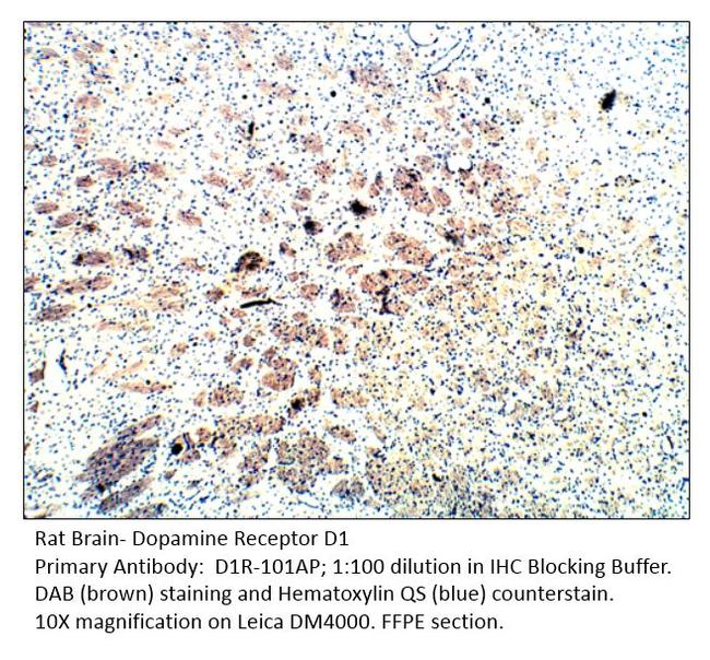 Dopamine Receptor D1 Antibody in Immunohistochemistry (IHC)