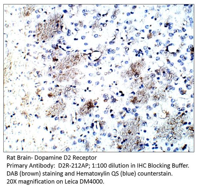 Dopamine D2 Receptor Antibody in Immunohistochemistry (IHC)