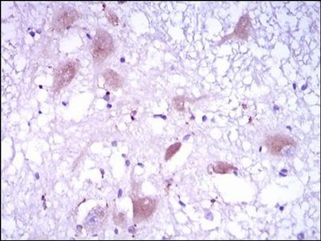 DKK3 Antibody in Immunohistochemistry (Paraffin) (IHC (P))