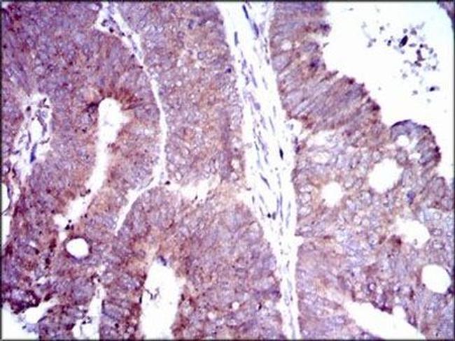 DLL4 Antibody in Immunohistochemistry (Paraffin) (IHC (P))