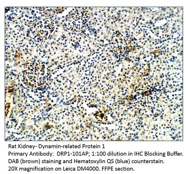 DRP1 Antibody in Immunohistochemistry (IHC)