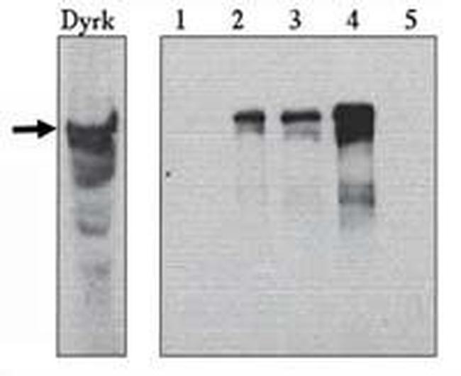 DYRK1A Antibody in Western Blot (WB)