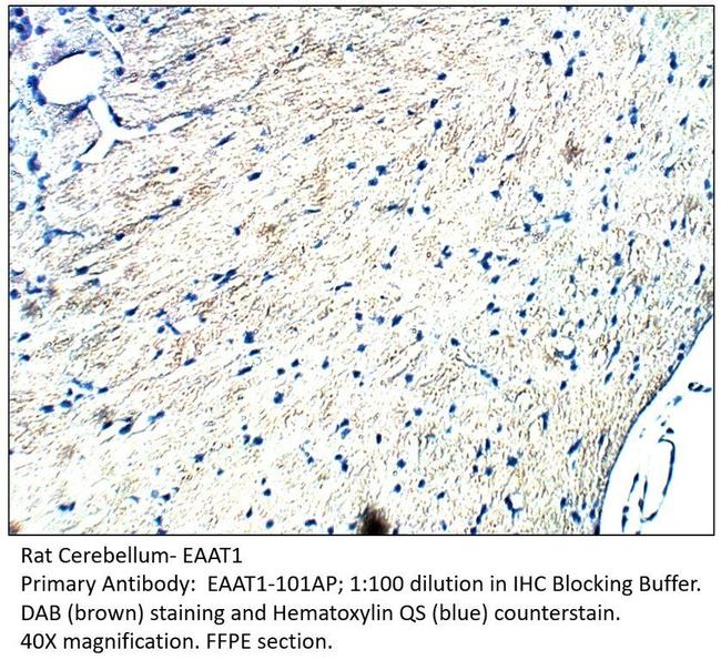 EAAT1 Antibody in Immunohistochemistry (IHC)