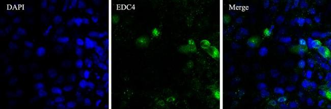 EDC4 Antibody in Immunocytochemistry (ICC/IF)